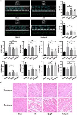 Qiliqiangxin Capsules Optimize Cardiac Metabolism Flexibility in Rats With Heart Failure After Myocardial Infarction